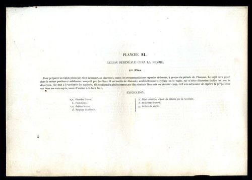Anatomie, Medizin Dammregion des Weibchens..2 antike Chromolithographien ... 1867 - Bild 2 von 4