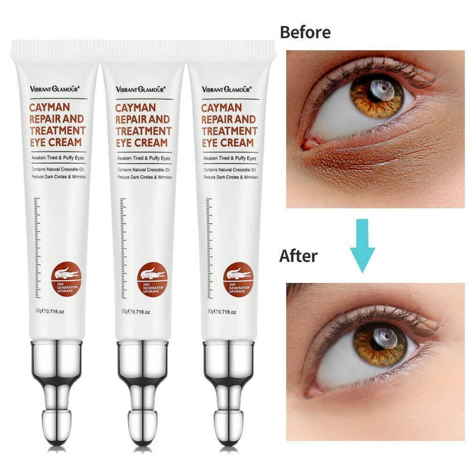 3x Eye Cream Instant Remove Eye Bags Dark Circles Anti Wrinkle Depuffing Firming - Image 4 of 4
