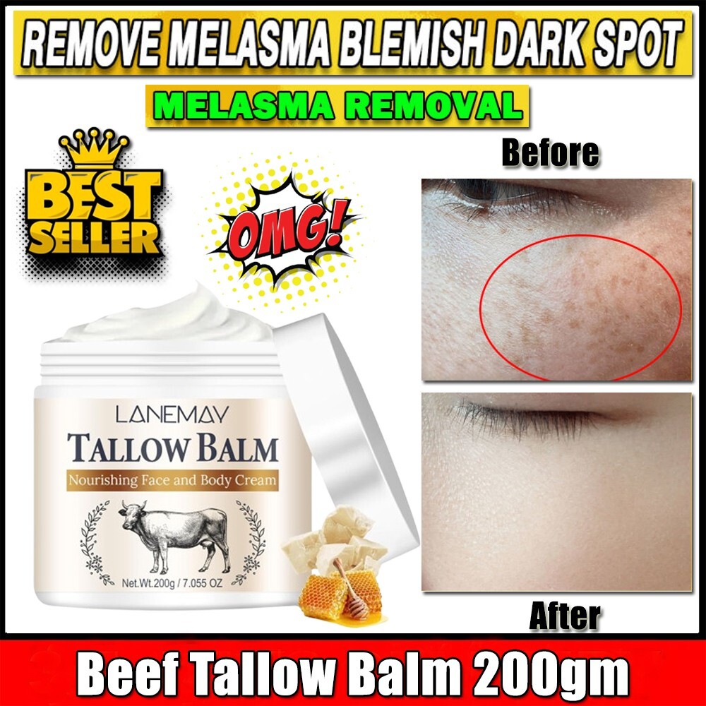 Whipped Tallow Moisturizer | 100% Natural Skincare | Deep Hydration 6.7 fl oz