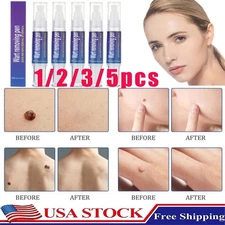 1-5pcs 12 Hours Wart Remover Pen Skin Tag Mole Foot Corn Eliminate Warts Unisex