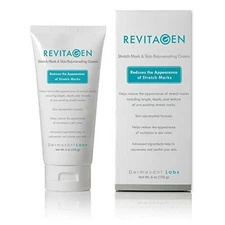 RevitaGen Stretch Mark Removal Cream, 6 oz.