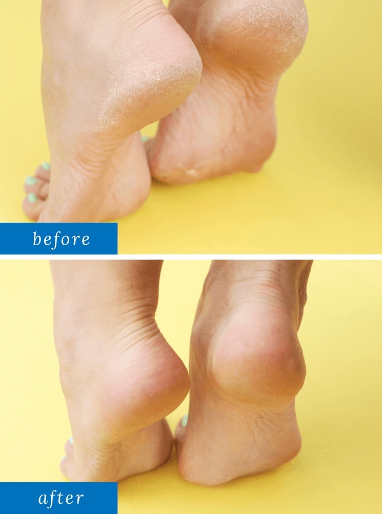 2 Packs Of MOISTURIZING SOCKS Luxurious Home Spa Treatment For Callused