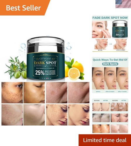 Nourishing Dark Spot Corrector Cream with Natural Ingredients for All Skin Types