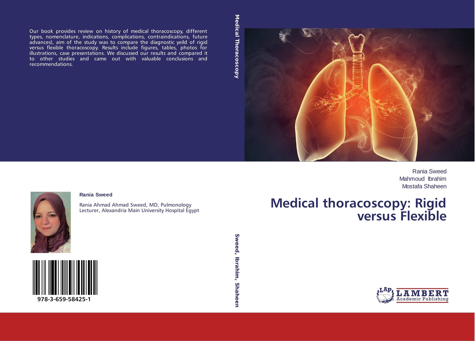 Thumbnail - Medical Thoracoscopy: Rigid Versus Flexible Rania Sweed (u. A.)