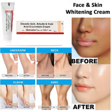 KOJIC ACID Skin Whitening Lightening Brightening Bleaching/Spot Fade cream 20gm