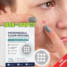 Curalona Microneedle Patches 144pcs, Skin Tag Wart Acne Remover Patches 20 OFF