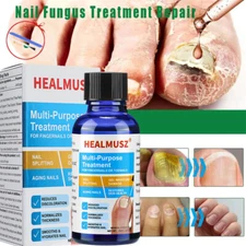 HEALMUSZ Antibacterial Fungal Nail Treatment Nail Repair Essential Oil Serum 30g