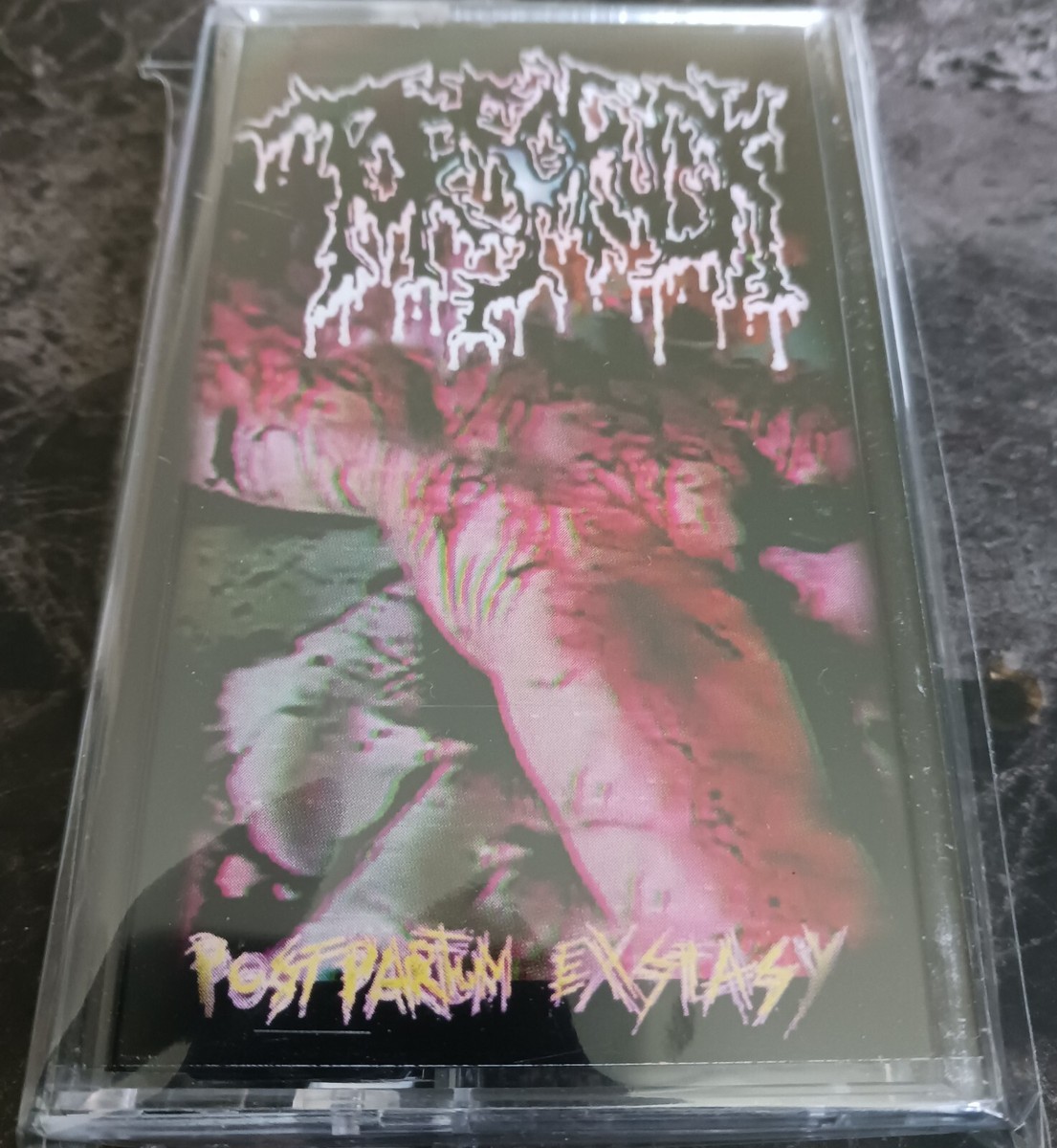 Torsofuck - Postpartum exstasy cassette | eBay