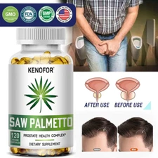 Saw Palmetto Capsules - Prevent Hair Loss Supports Hair & Prostate Health