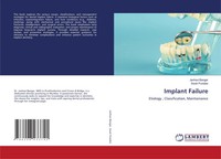 Implant Failure Etiology , Classification, Maintainance Janhavi Bangar (U. A.)