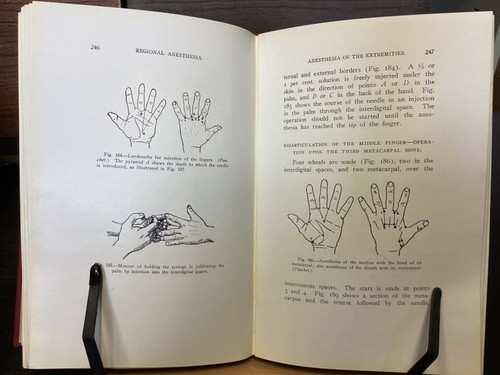 1922 Regional Anesthesia (Victor Pauchet's Technique) by B. Sherwood-Dunn - Picture 13 of 14