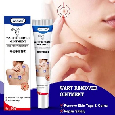 20g Warzenentferner Salbe Warze Behandlung Creme Hautanhängsel Entferner Kräuter