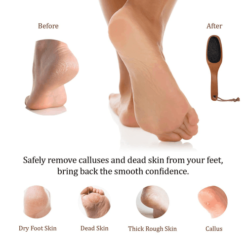 Pumice Stone for Feet & Foot Brush with Handle 2 in 1 Natural Wood Pedicure - Picture 6 of 7