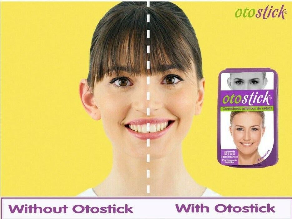 Otostick Ear Correctors First Impression/Demo