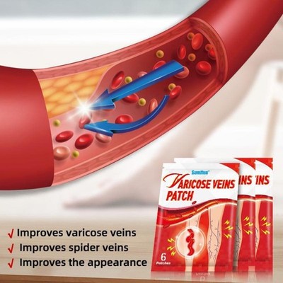  Varicose Vein Microneedle Patch Relieve Leg Swelling Patch External/UK  UK P4G7