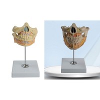 Dental Anatomy Model, Permanent Tooth Model For Dental Diseases Study