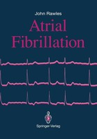 Atrial Fibrillation | John Rawles | Englisch | Taschenbuch | Xii | 2011