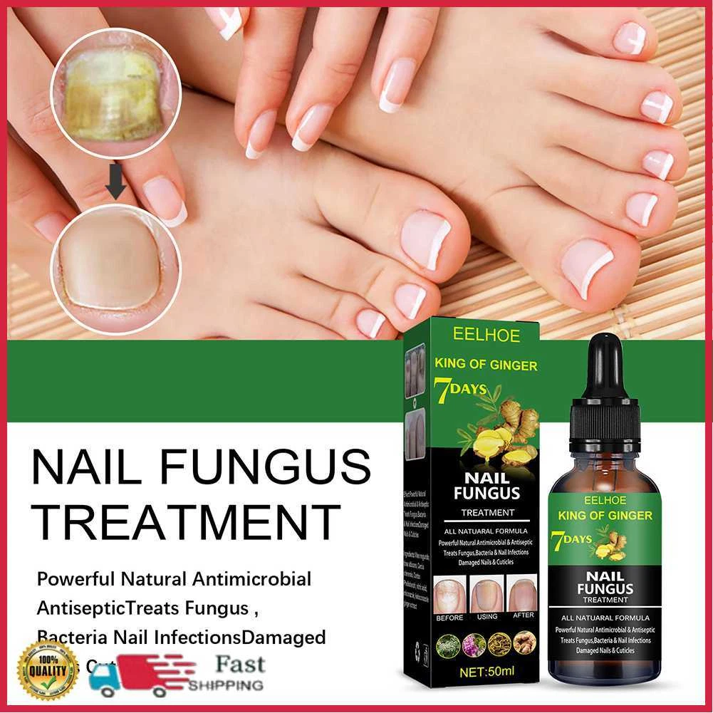 Aggregate more than 118 green bacterial nail infection latest ceg.edu.vn