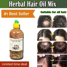 Herbal Hair Oil Mix of 21 Herbs for Thick Long Hair Growth FS
