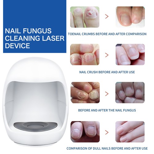 Nail Fungus Laser Device Light, Therapy Fungus Toes Treatments Devices - Picture 5 of 12