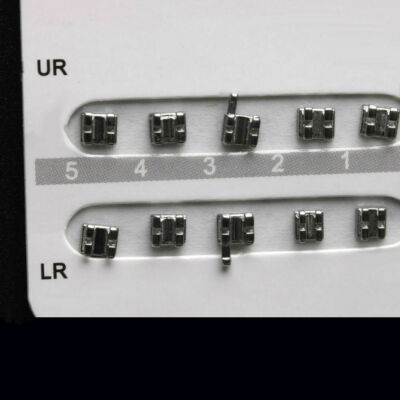 Lot De 20 Attaches/brackets Orthodontiques Mini Edgewise 022 Avec Crochets - AZDENT