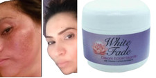 WHITE FADE CREAM: ELIMINAN LAS MANCHAS OSCURAS DE LA PIEL EN SOLO 2 SEMANAS  2oz