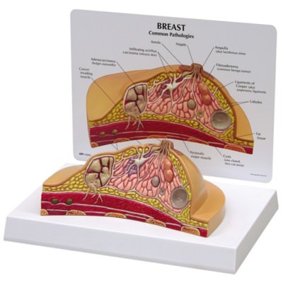 Breast CrossSection GPI Anatomy Model wKey  LFA #3450 Make Us an Offer SEE VIDEO