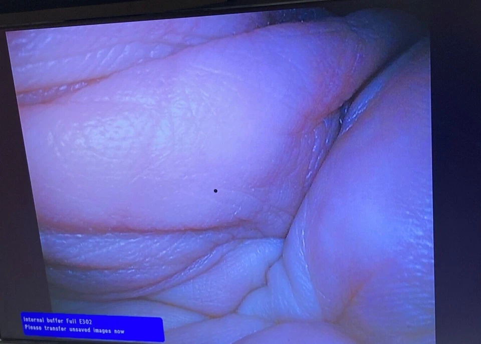 Video laparoscopio Olympus WA50011A EndoEye autoclavable 10 mm 0 ° HD con bandeja Foto 3 de 4