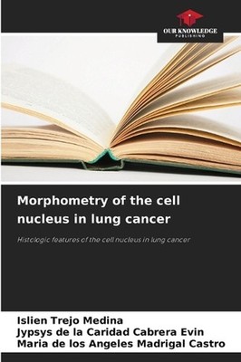 Morphometry of the cell nucleus in lung cancer by Islien Trejo Medina Paperback 