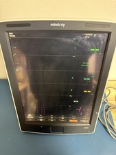 Mindray V21 Patient Monitor