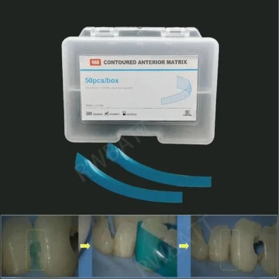 RWBATT Dental Contoured Anterior Matrix Bands Polyester Anterior Strips Matrices System