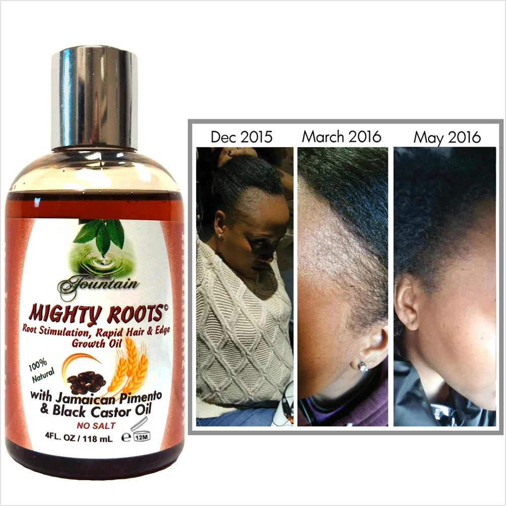 Receding Hairline & Thin Hair Growth Oil - Jamaican Pimento Black Castor Oil