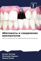 Sahil Luthra (U. A.) | Abatmenty I Soedineniq Implantatow | Taschenbuch (2022)
