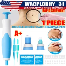 Auto Micro Skin Tag Remover Device Kit Safe Painless Removal 2-8 mm Band Tool