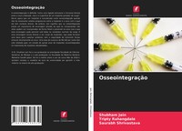 Shubham Jain (U. A.) | OsseointegraçãO | Taschenbuch | Portugiesisch (2021)
