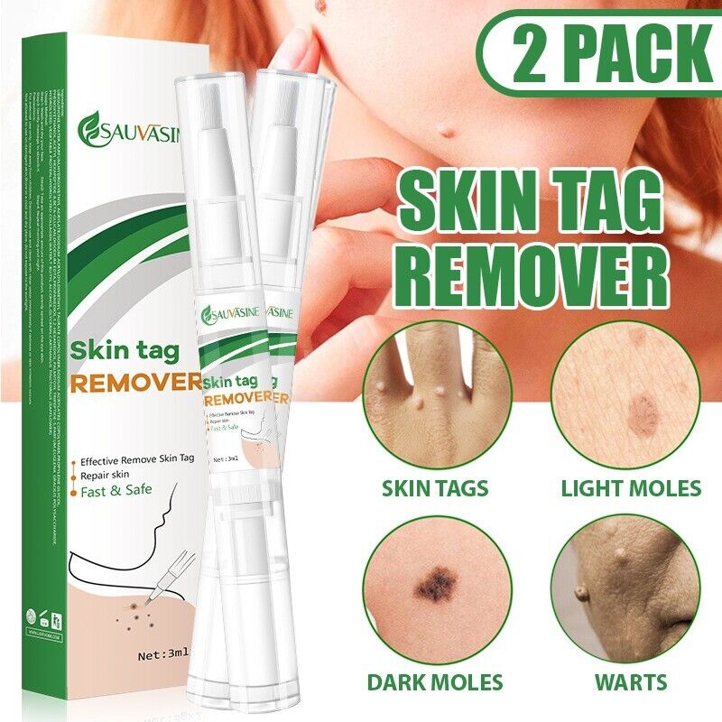 2 PACK Painless & Safe Skin Tag Remover Pen Skin Tag Mole Wart Dark Spot Remover