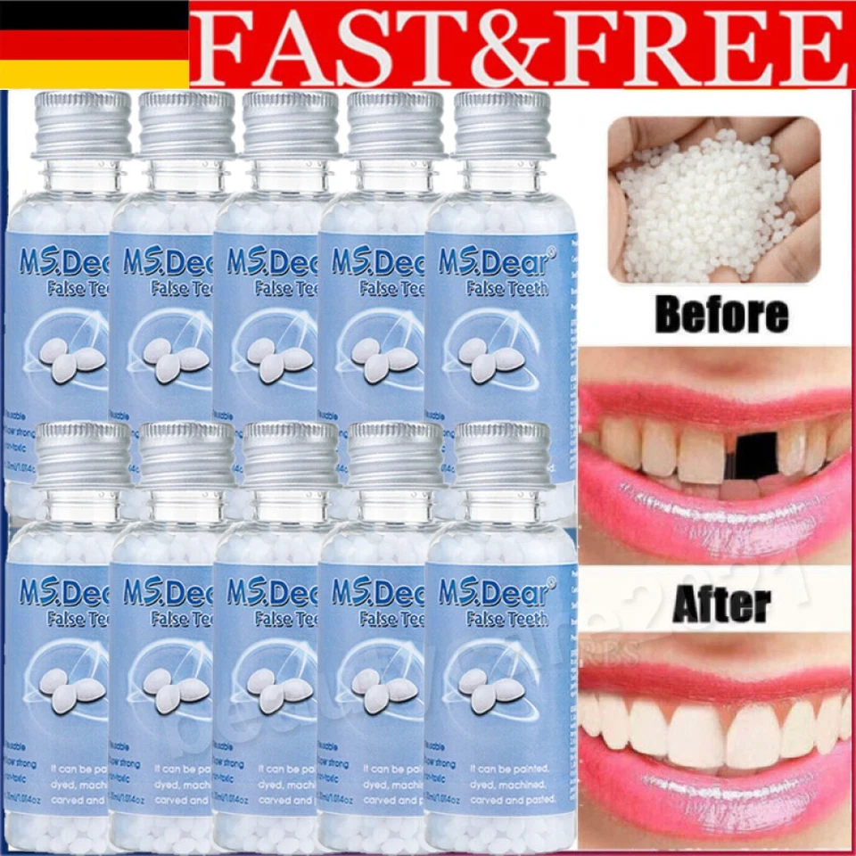 MS.DEAR 10X Temporäre Zahnreparaturperlen Zahn Reparatur Set Kleber Zahnperlen Zahnersat