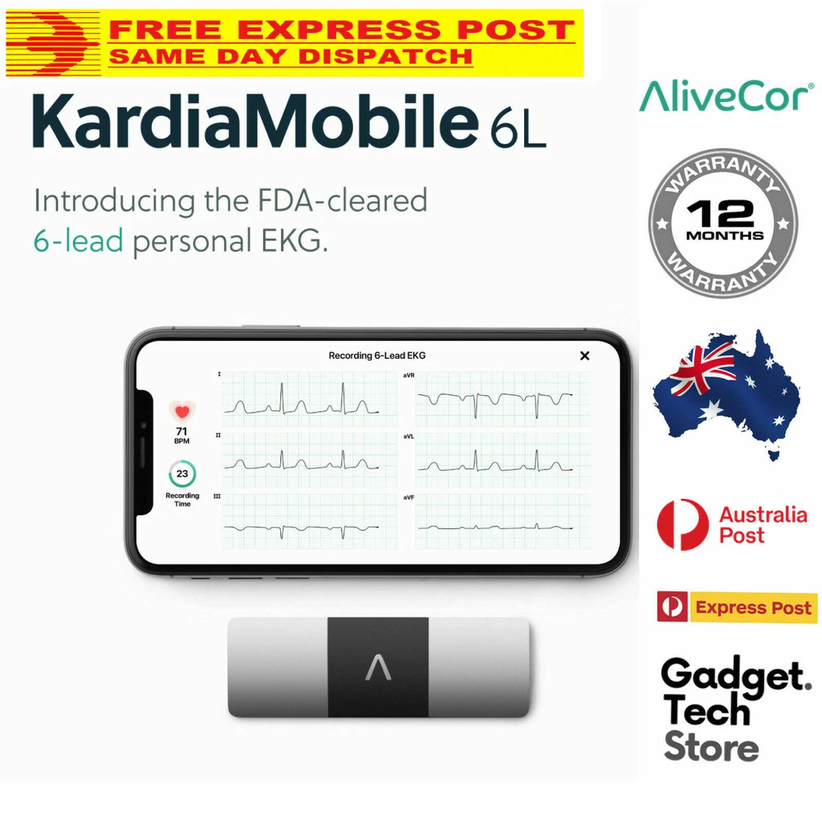 KARDIAMOBILE AliveCor KardiaMobile 6L Portable EKG Monitor, 59 OFF