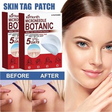 45 PCS Microneedle Botanic Skin Tag  Acne Patch Skin Tag Remover Patches HOT