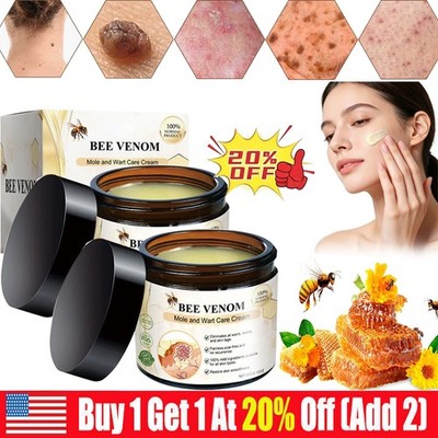 Bee Venom Skin Tag Removal Treatment Cream Body Care Mole Corn Wart Remover