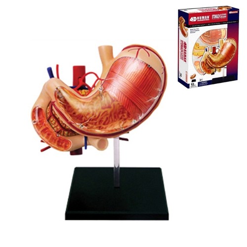 Human Stomach & Pancreas Medical Model Stomach Pathology Anatomy Teaching Tool - Picture 5 of 8