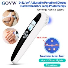 6 Diodes 308nm Excimer Ultraviolet Skin Deseases Treatment Light Therapy Device