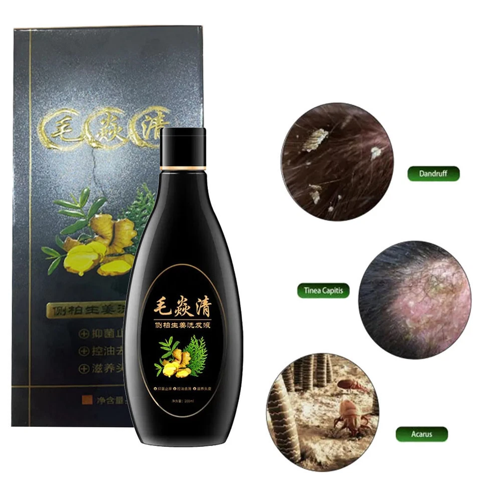 Шампунь 2024 Scalp Hair Follicle антибактериальный против зуда клещей масло контроль сделано в США - Изображение 3 из 4