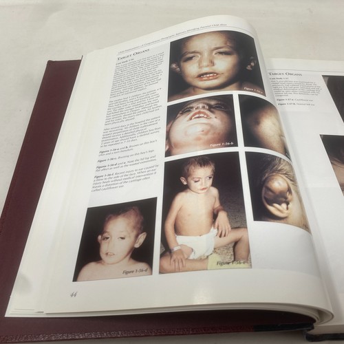 CHILD MALTREATMENT Photographic Reference Child Abuse 2005 3rd Ed. Hardcover - Bild 9 von 10