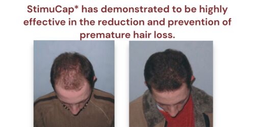 Anti-Haarausfall Shampoo mit Stimucap & Kupfer Peptiden, Marseille reines Element - Bild 4 von 4