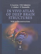 In Vivo Atlas of Deep Brain Structures | With...