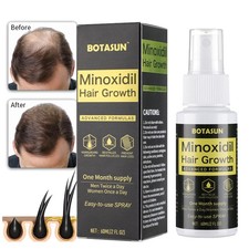 Minoxidil 5 Hair Regrowth Treatment Topical Solution for Men 1 Month Supply