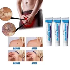 (paquete de 3) Tratamiento De Eliminacion De Verrugas Genitales Y Vph 2 Oz x 3