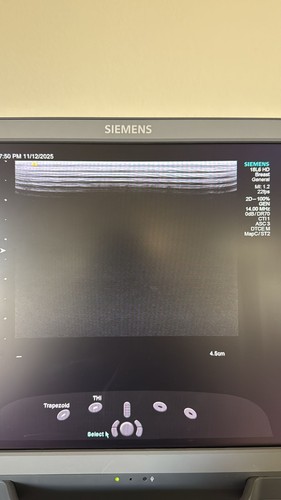 ACUSON SIEMENS 18L6 HD ULTRASOUND TRANSDUCER SN: 84844041 - Picture 2 of 6