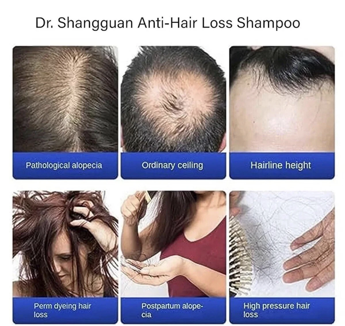 Anti hair sale loss